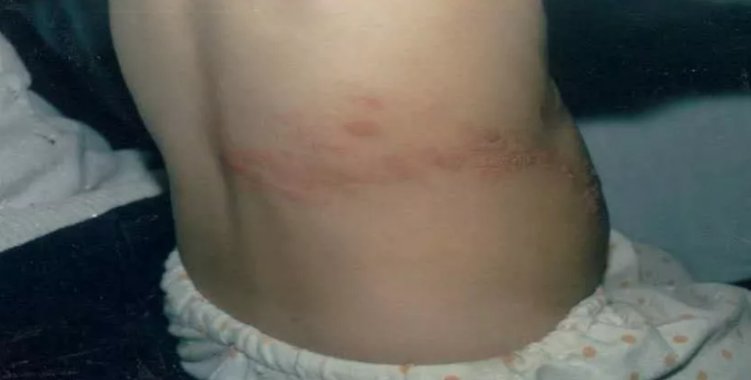 所谓的皮蛇是什么东西呢