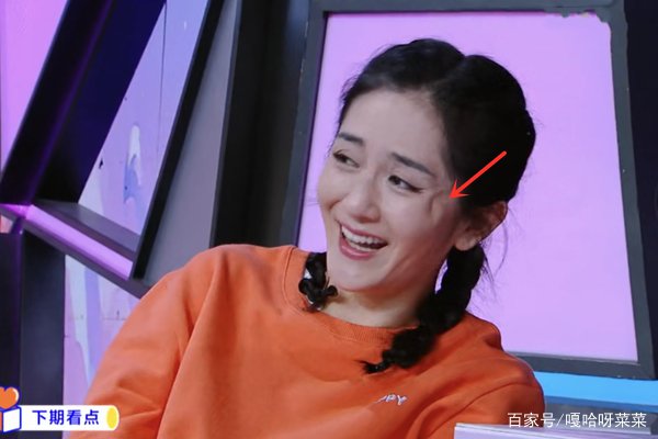 谢娜整容疑失败,眼角惊现凹坑好吓人,还配得到粉丝支持吗?