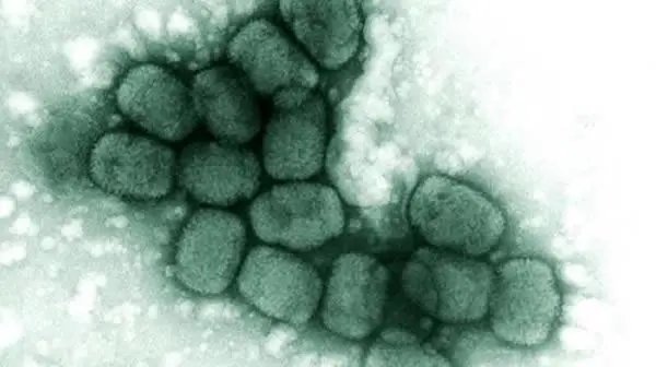 猴痘病毒最新基因测序公布，与三年前英国毒株相近，还有哪些特点？