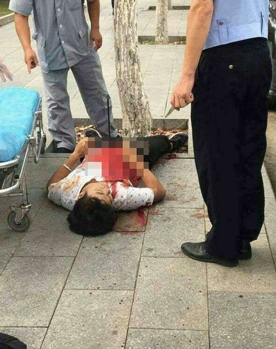 男子路边中箭受伤事件有最新消息了吗？