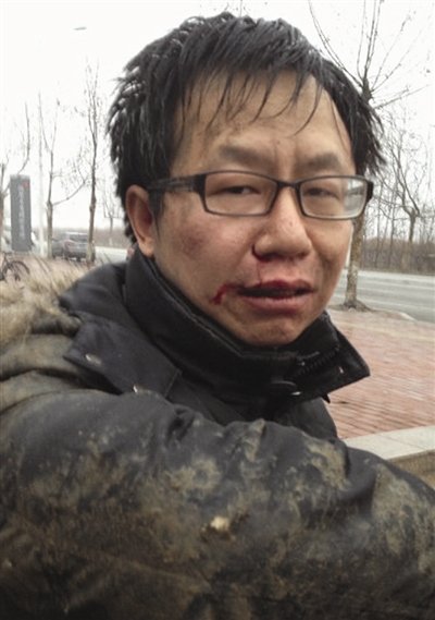 陈宝成的刑事拘留