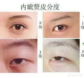 什么是蒙古褶？