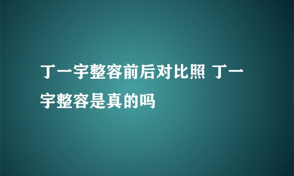 丁一宇整容前后对比照 丁一宇整容是真的吗