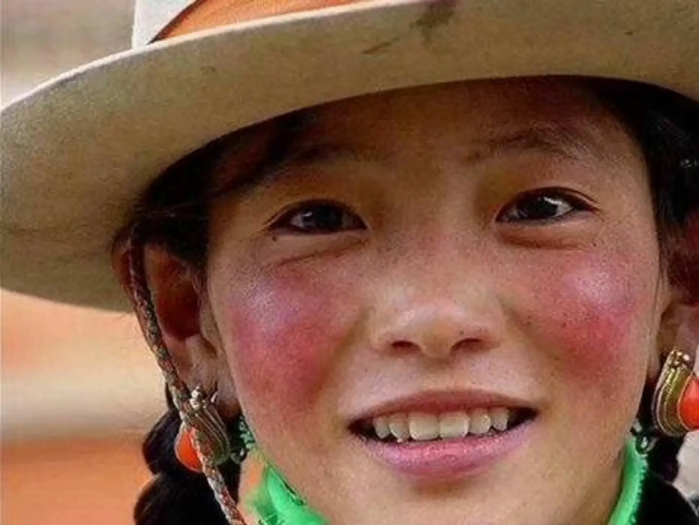 一女子感染新冠高烧后满脸发黑，发烧为何会引起脸发黑的现象呢？