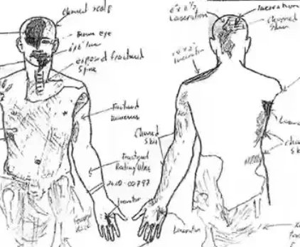 科比死了吗?为什么?