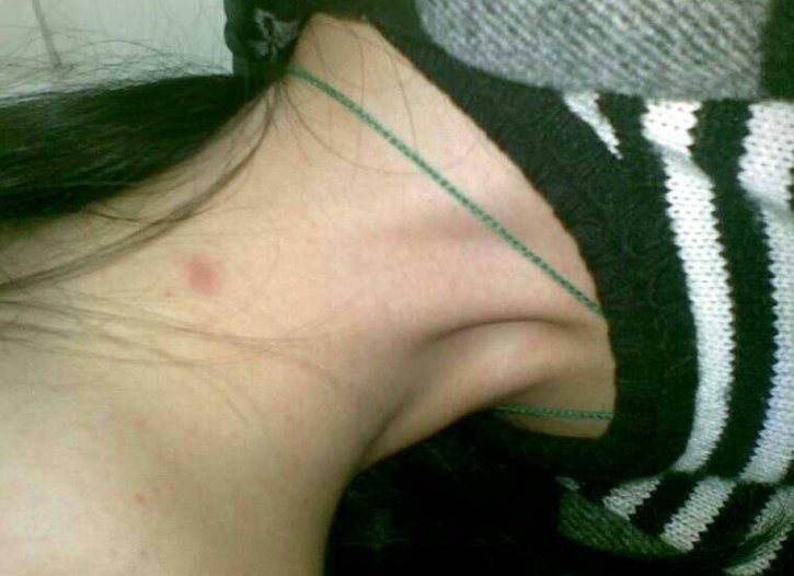 男人种草莓是什么心理