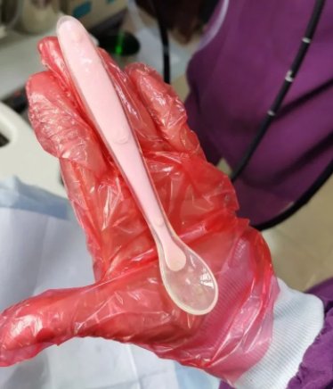 广东女子把17厘米长勺子吞了下去，此女子为何这么做？