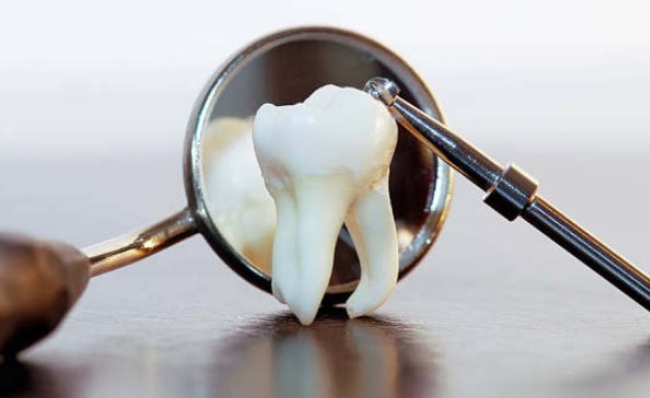 江西一男子看完《长津湖》学吃冻土豆后拔3颗牙，哪些人不适宜吃冻土豆？