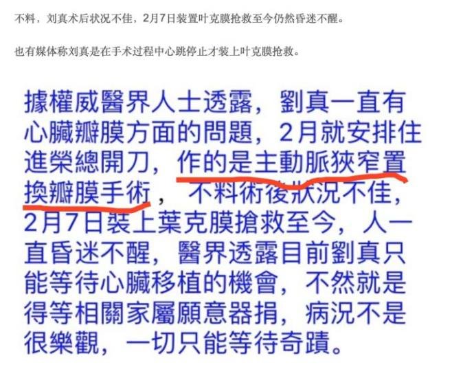 刘真什么原因走的？刘真手术为什么会出现意外