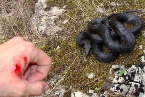 广东惠城区水口惊现14斤眼镜王蛇，不小心被被蛇咬之后该怎么办？