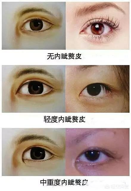 什么是蒙古褶？