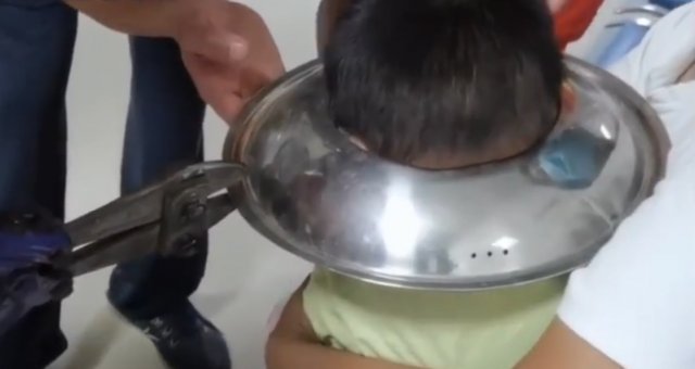 江苏男孩头卡进了锅盖，哭得嗷嗷叫，怎么回事？
