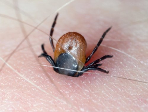 老人因蜱虫病去世后，为其净身3人也相继去世，有多可怕？