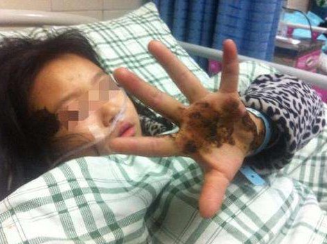 别墅内养26桶蜜蜂导致邻居整张脸被蛰肿是怎么回事？