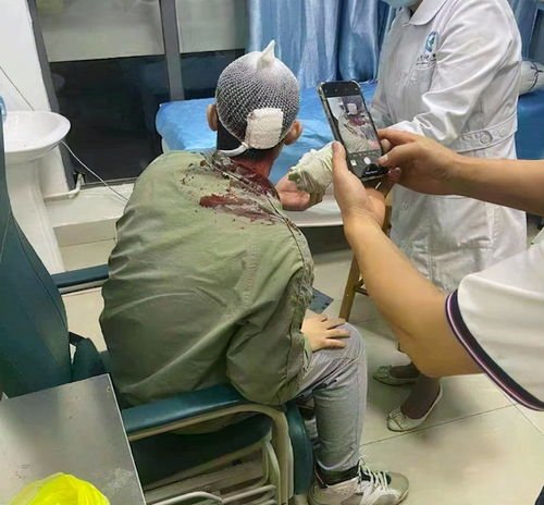广东医科大学一女生持玻璃瓶打伤男生,此事究竟谁之过?
