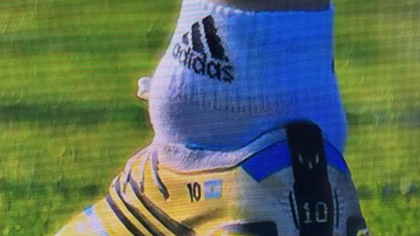 需谨慎！梅西被拍到左脚踝隆起大包，为何运动员很容易受伤？