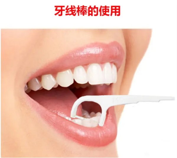 floss是什么意思