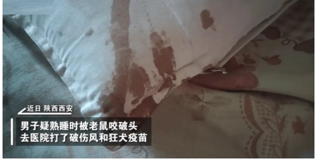 男子熟睡时疑被老鼠咬破头,被老鼠咬到需要打狂犬疫苗吗?